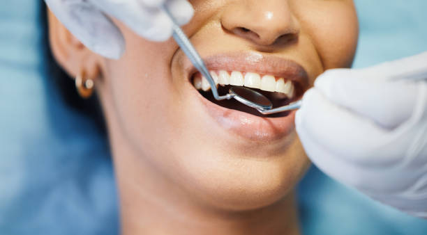 Emergency Dental Filling Replacement in CT