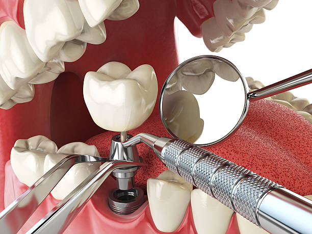 Best Urgent Tooth Repair  in South Windham, CT