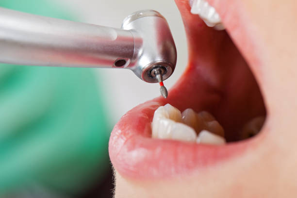 Dentist for Dental Trauma in CT